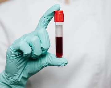 Minicurso gratuito sobre Flebotomia é ministrado no UniFBV Wyden